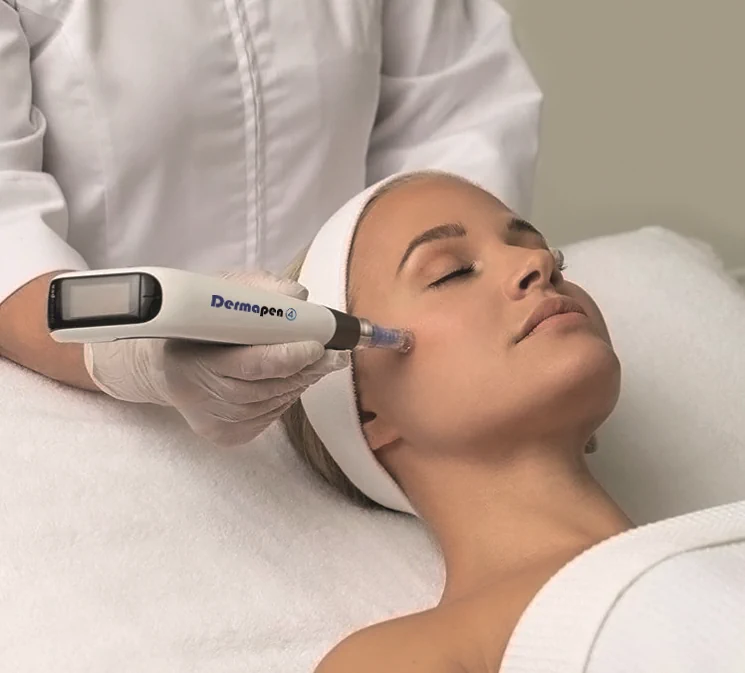 The Benefits of Dermapen Microneedling