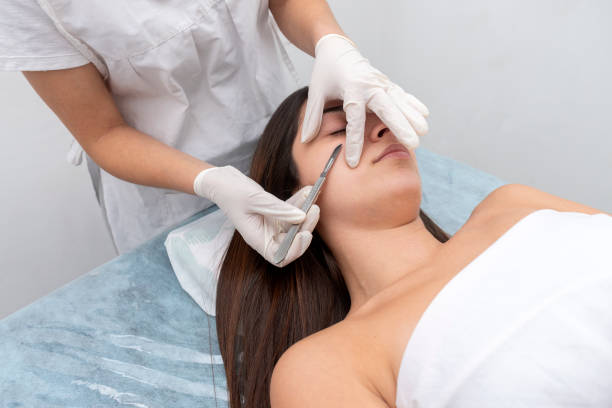 Debunking Dermaplaning Myths